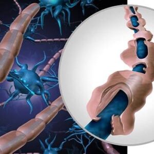 پاورپوینت آشنایی با سندروم گیلن باره