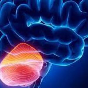 پاورپوینت آشنایی با ناهنجاری مغزی آرنولد کیاری