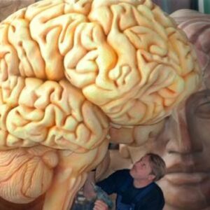 دانلود پاورپوینت سکته مغزی